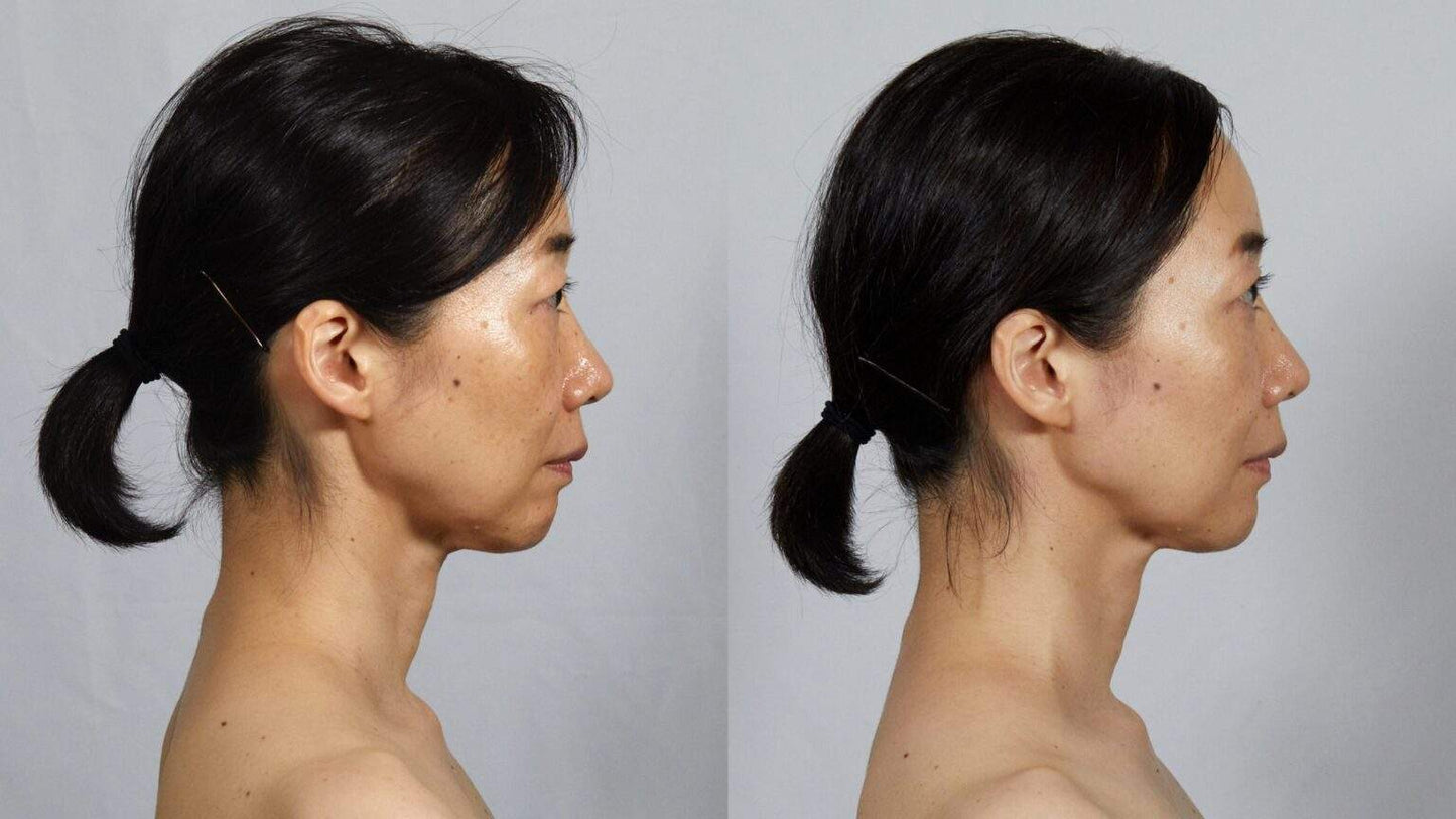 Face Player II