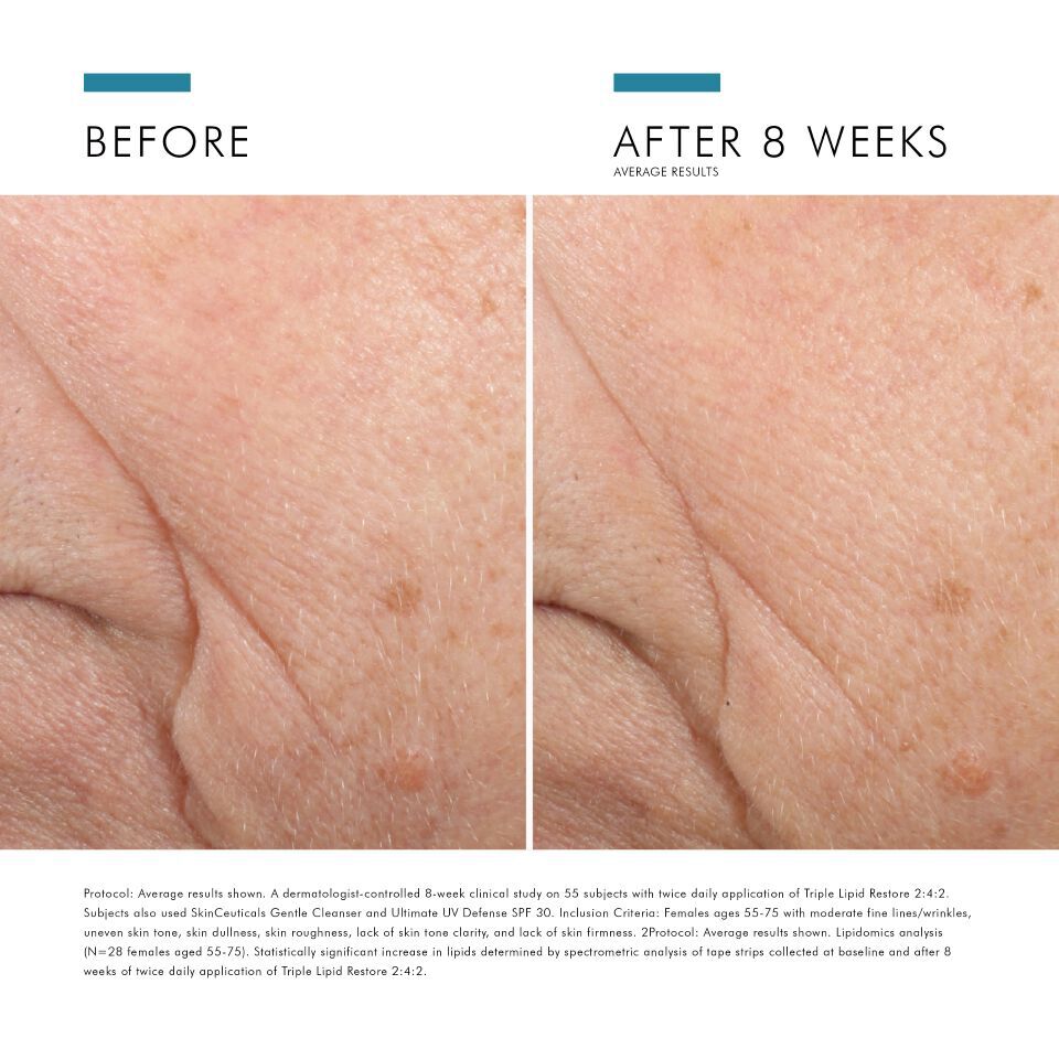 Triple Lipid Restore 242 Anti Aging Moisturiser