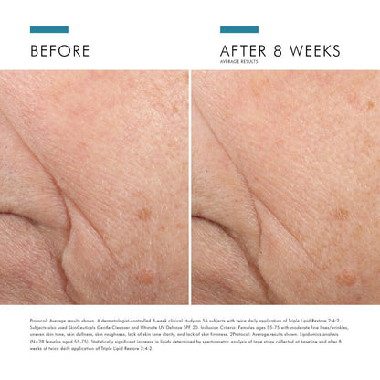 Triple Lipid Restore 242 Anti Aging Moisturiser
