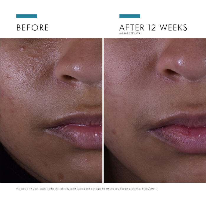 Silymarin CF 30ml