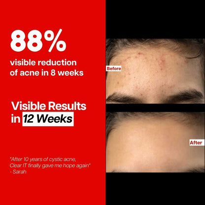 Ventamin Clear It Daily Skin Support Supplement for Clearer Looking Skin