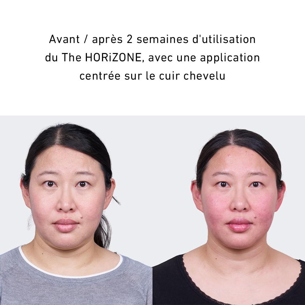 HORiZONE