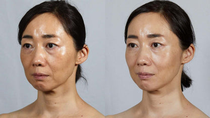 Face Player II