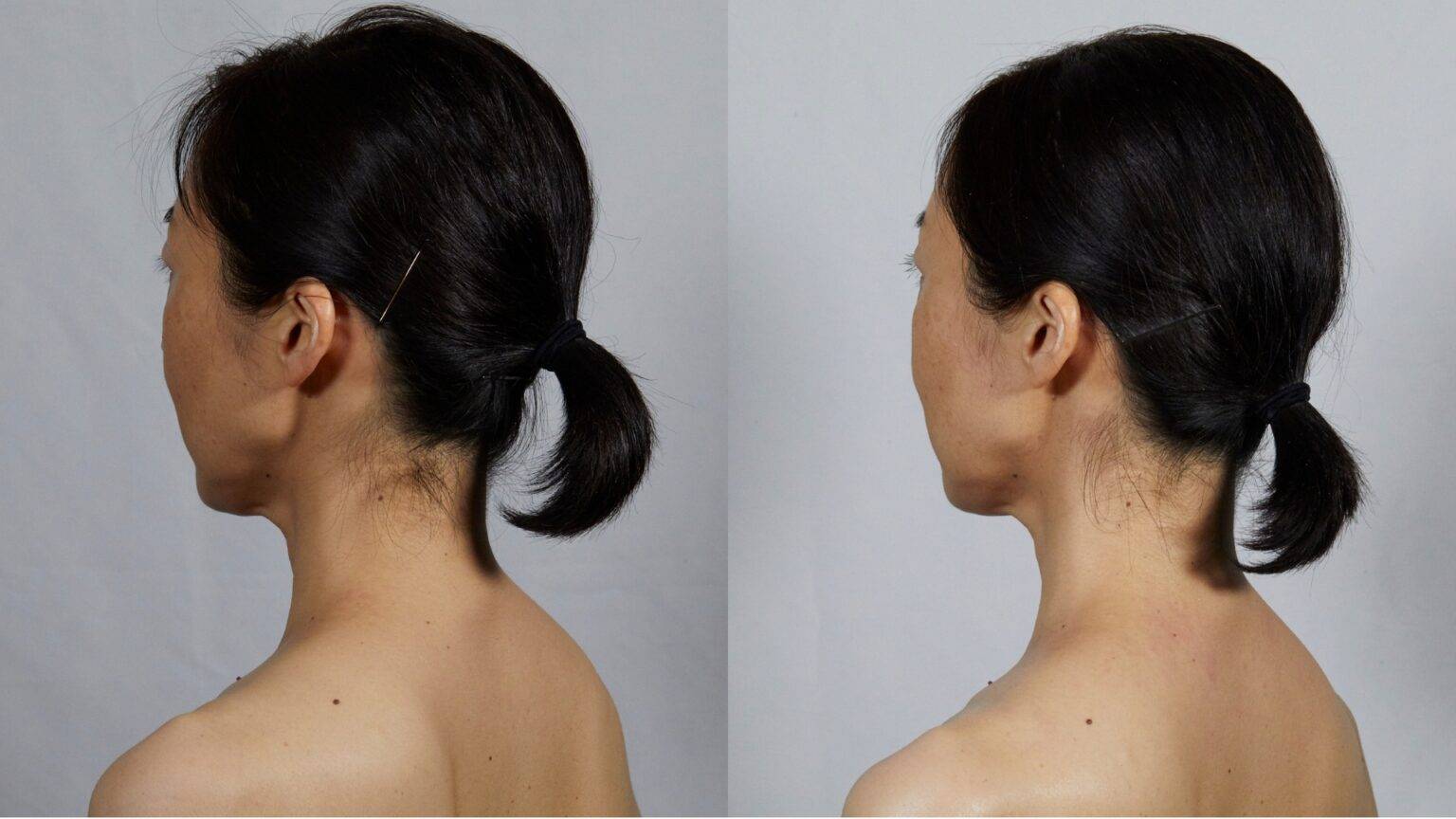 Face Player II